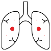 Tuberculosis icon
