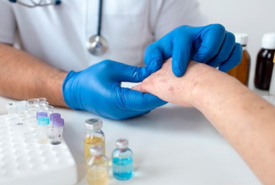 conjunctivitis treatment