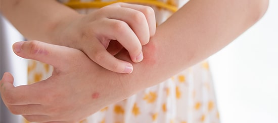 in house mono treatment