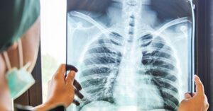Get Bronchitis And Pneumonia Treatment at Fam Urgent Care