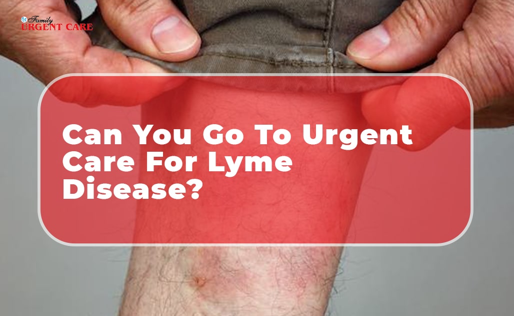 urgent care for lyme disease