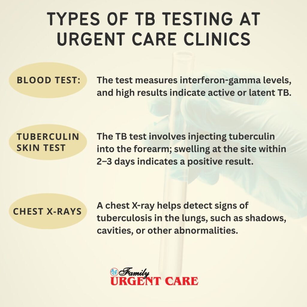 Types of TB Testing at Urgent Care