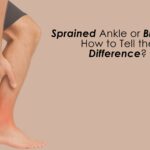 Sprained Ankle or Broken