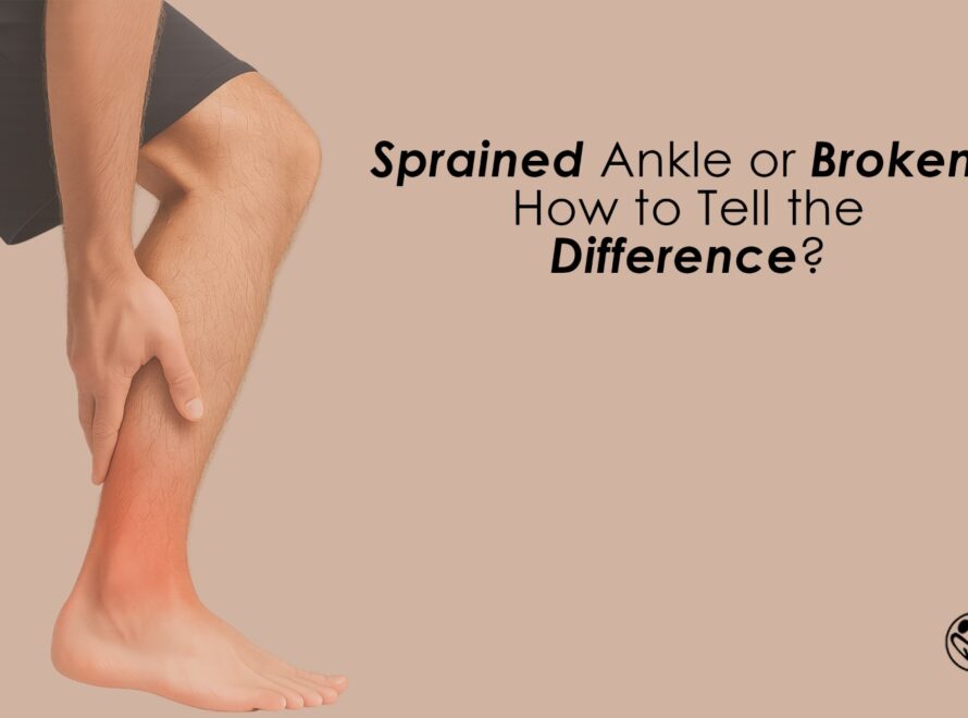 Sprained Ankle or Broken