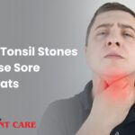 Can Tonsil Stones Cause Sore Throats