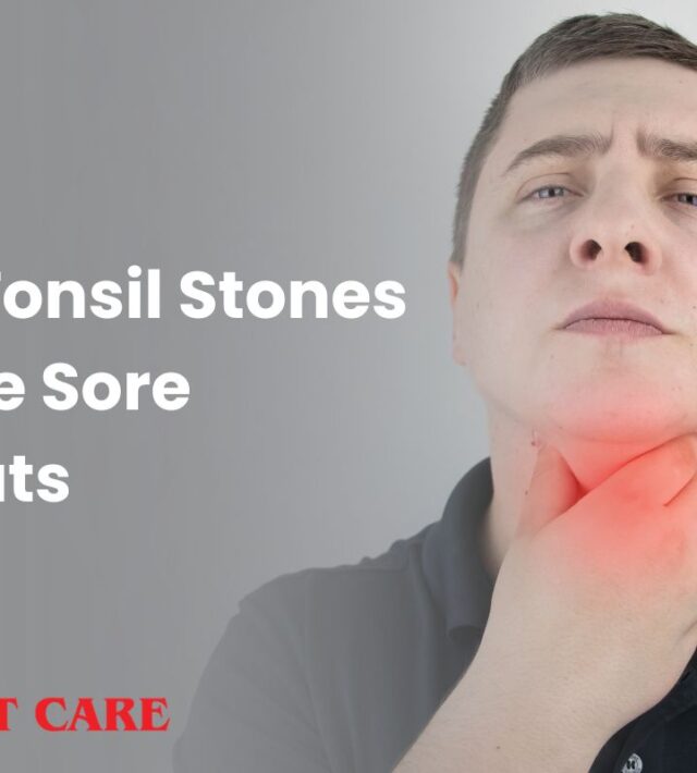 Can Tonsil Stones Cause Sore Throats