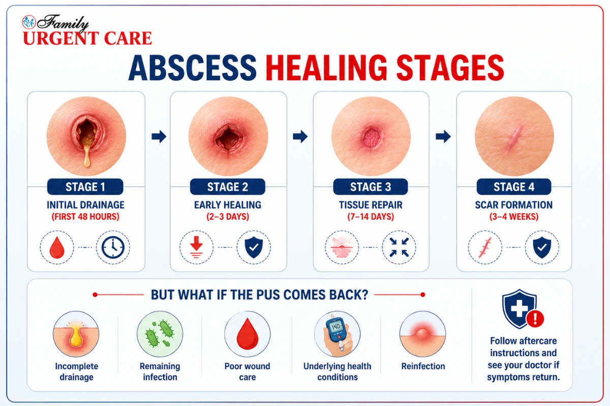 Abscess Healing Stages