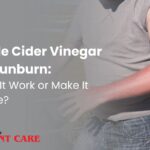 Apple cider vinegar for sunburn