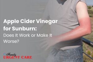 Apple cider vinegar for sunburn