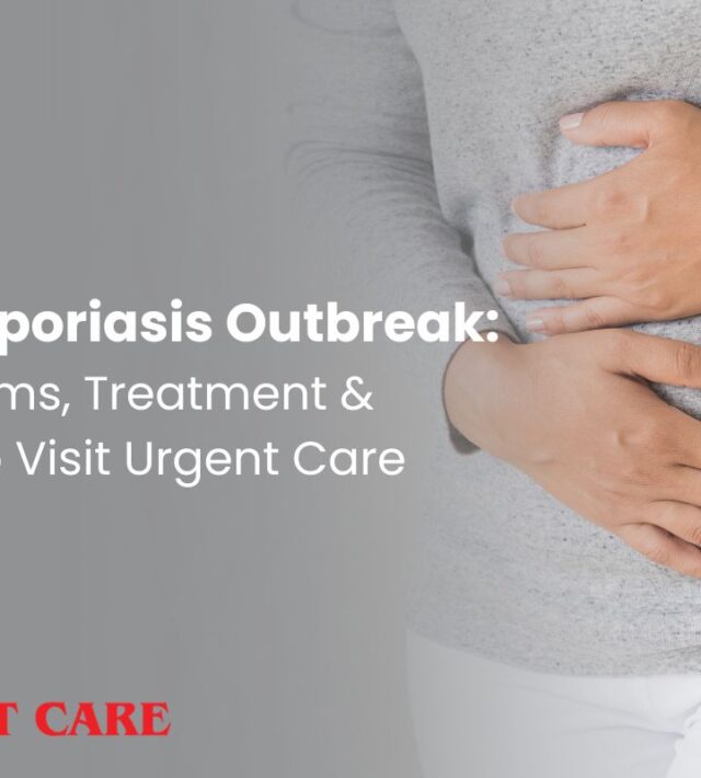 Cyclosporiasis Outbreak and when to visit urgent care