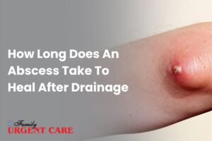 How Long Does An Abscess Take To Heal After Drainage