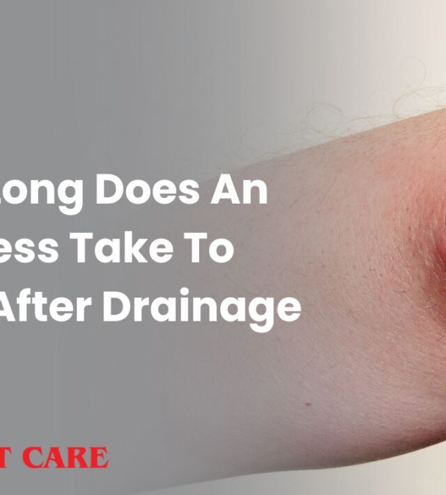 How Long Does An Abscess Take To Heal After Drainage