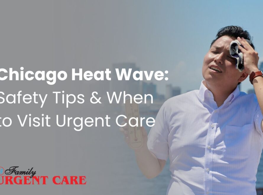 Chicago Heat Wave: Safety Tips & When to Visit Urgent Care