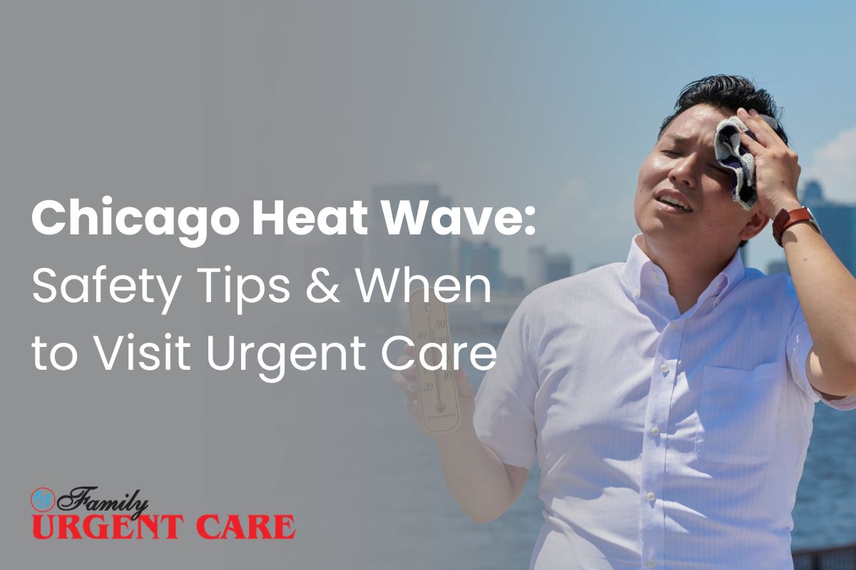Chicago Heat Wave: Safety Tips & When to Visit Urgent Care