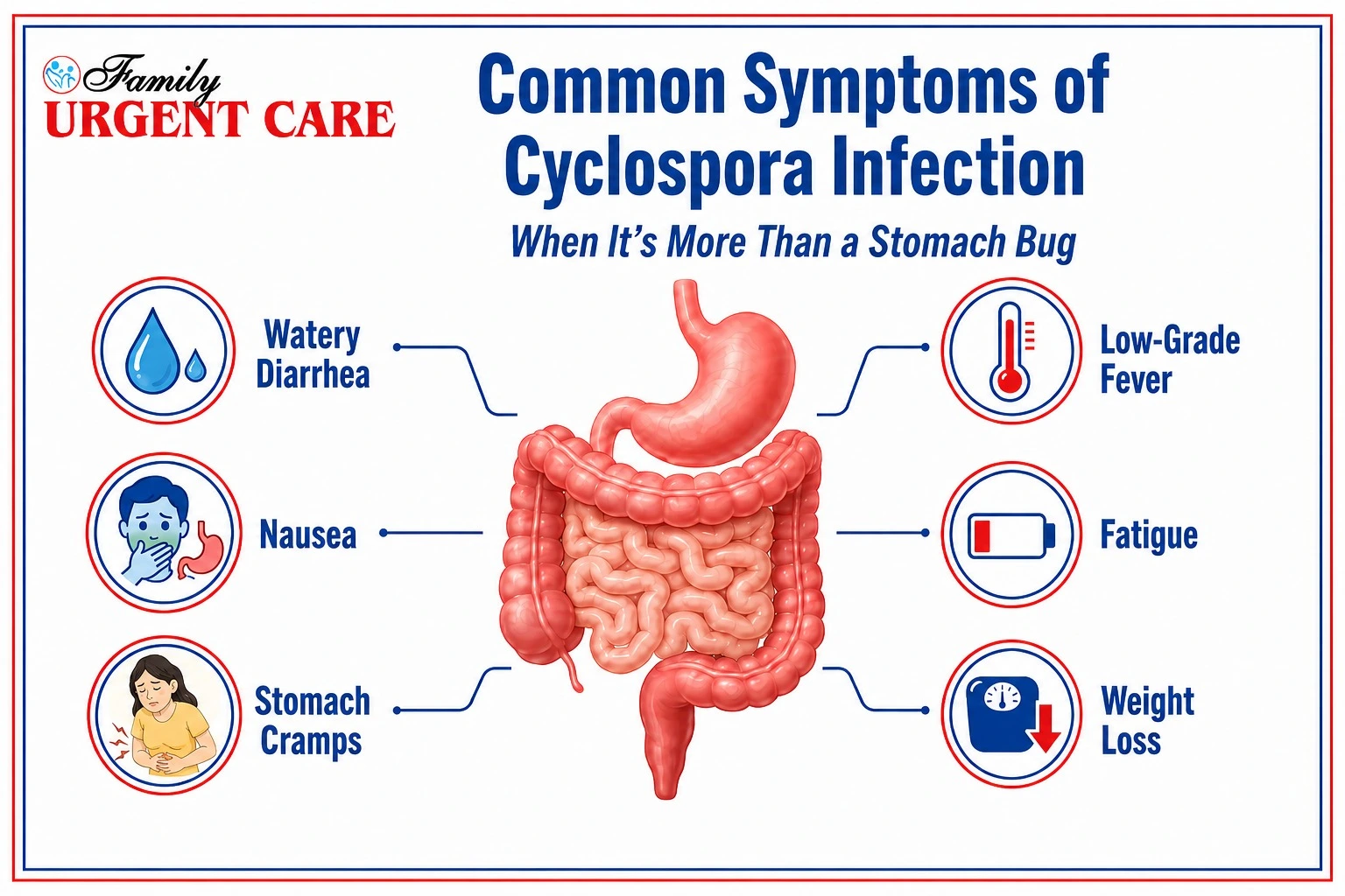 Symptoms of Cyclospora Infection