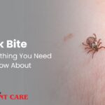 Tick bite every you need to know about