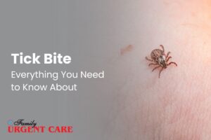 Tick bite every you need to know about