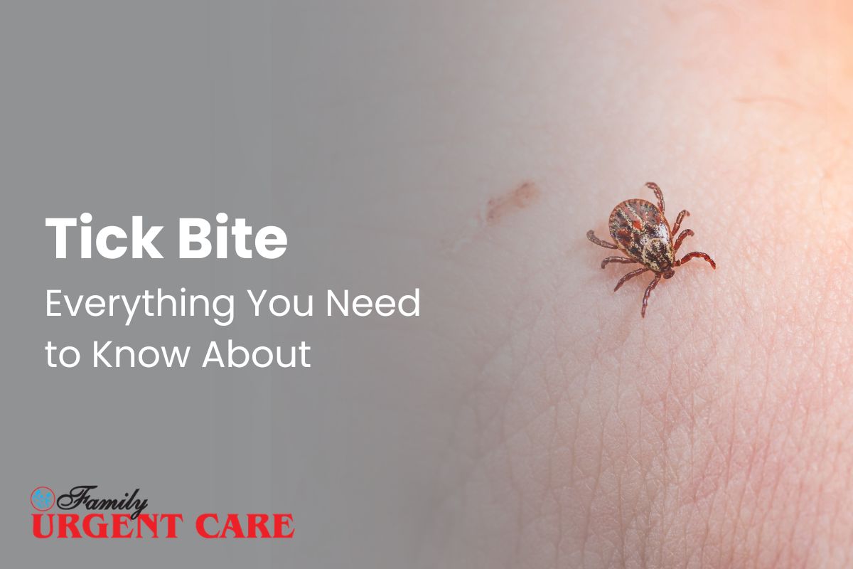 Tick bite every you need to know about